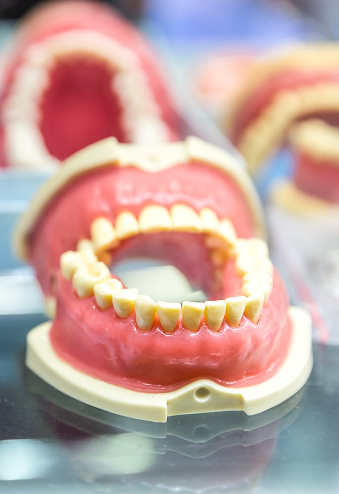 Tratament endodontic in apropiere de RACADAU (VALEA CETATII)